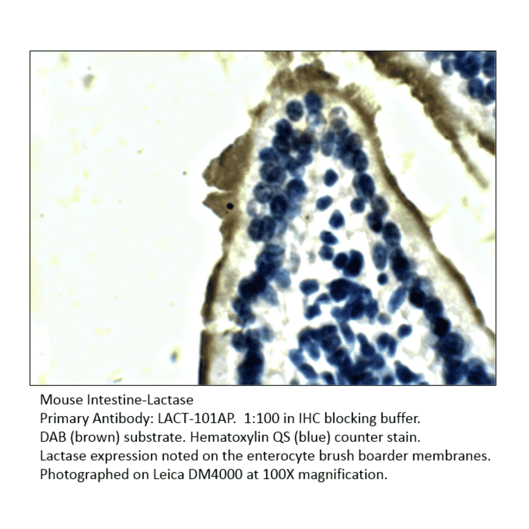 Anti-Lactase (LCT) Antibody from FabGennix (LACT-101AP) - Antibodies.com