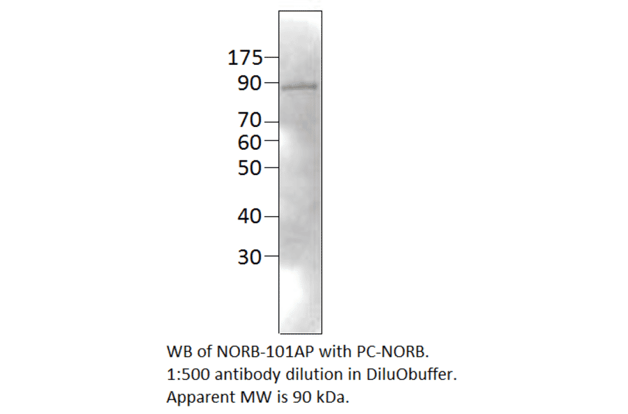 Anti-Neurochondrin Antibody from FabGennix (NORB-101AP) - Antibodies.com
