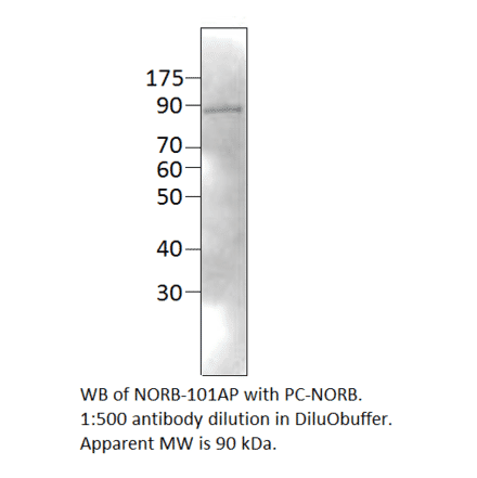 Anti-Neurochondrin Antibody from FabGennix (NORB-101AP) - Antibodies.com