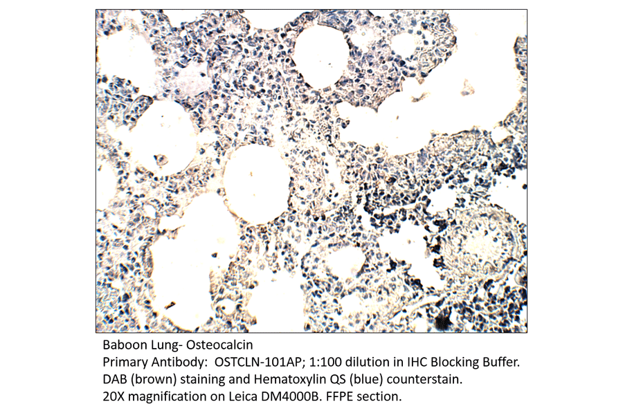 Anti-Osteocalcin Antibody from FabGennix (OSTCLN-101AP) - Antibodies.com