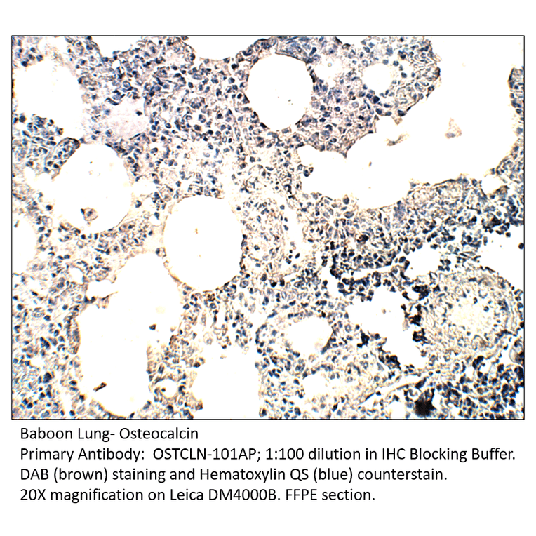 Anti-Osteocalcin Antibody from FabGennix (OSTCLN-101AP) - Antibodies.com