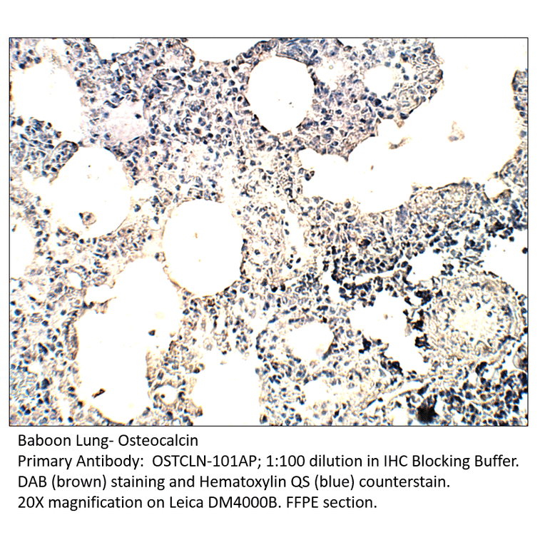 Anti-Osteocalcin Antibody from FabGennix (OSTCLN-101AP) - Antibodies.com