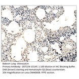 Anti-Osteocalcin Antibody from FabGennix (OSTCLN-101AP) - Antibodies.com