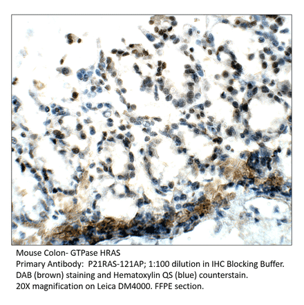 Anti-GTPase HRAS Antibody from FabGennix (P21RAS-121AP) - Antibodies.com