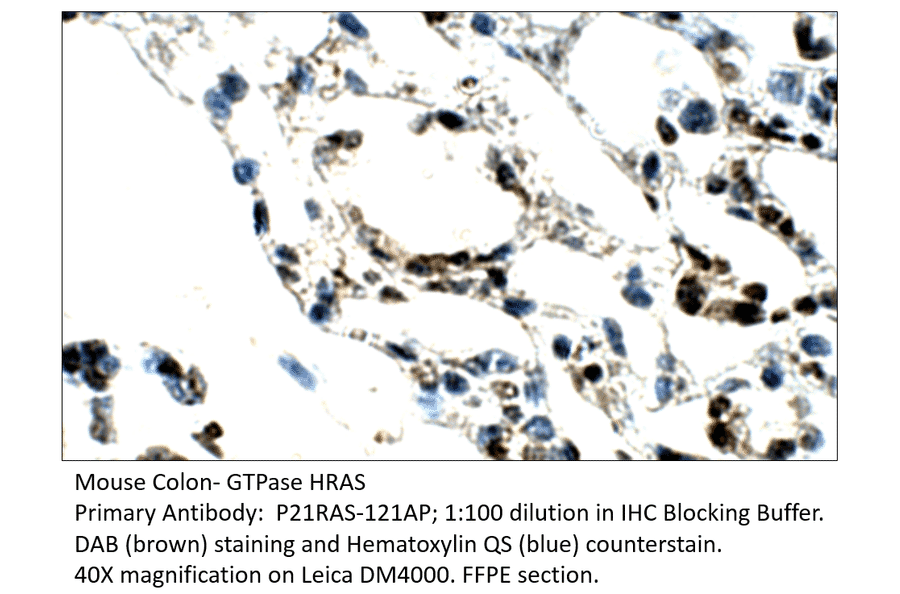 Anti-GTPase HRAS Antibody from FabGennix (P21RAS-121AP) - Antibodies.com