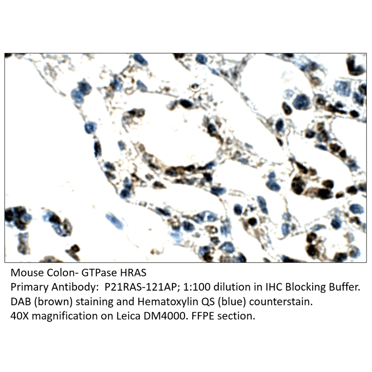 Anti-GTPase HRAS Antibody from FabGennix (P21RAS-121AP) - Antibodies.com
