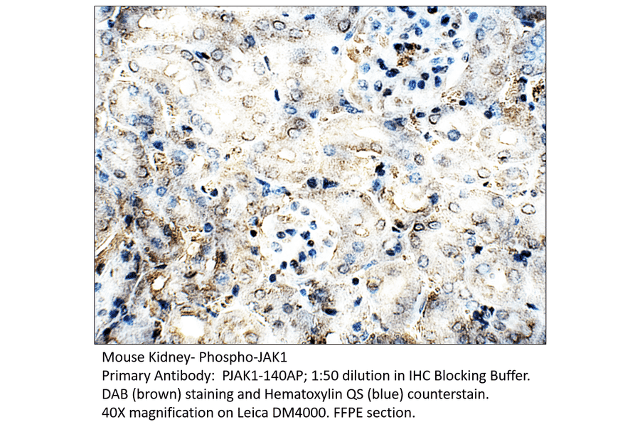 Anti-Phospho-JAK1 Antibody from FabGennix (PJAK1-140AP) - Antibodies.com