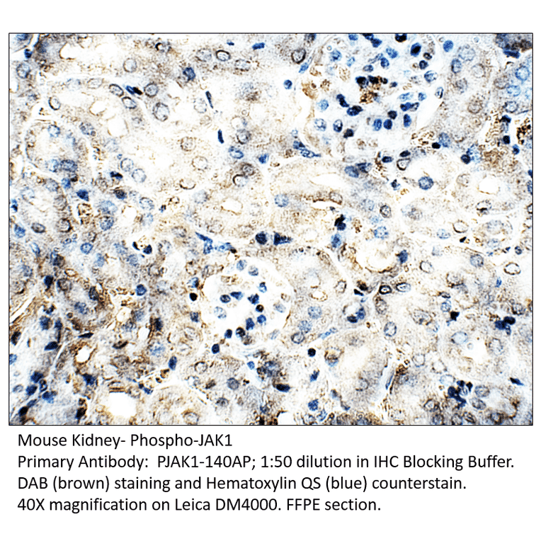 Anti-Phospho-JAK1 Antibody from FabGennix (PJAK1-140AP) - Antibodies.com