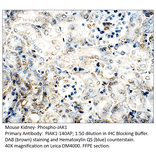 Anti-Phospho-JAK1 Antibody from FabGennix (PJAK1-140AP) - Antibodies.com