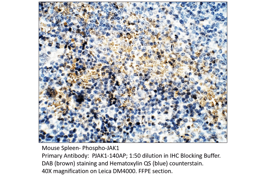 Anti-Phospho-JAK1 Antibody from FabGennix (PJAK1-140AP) - Antibodies.com
