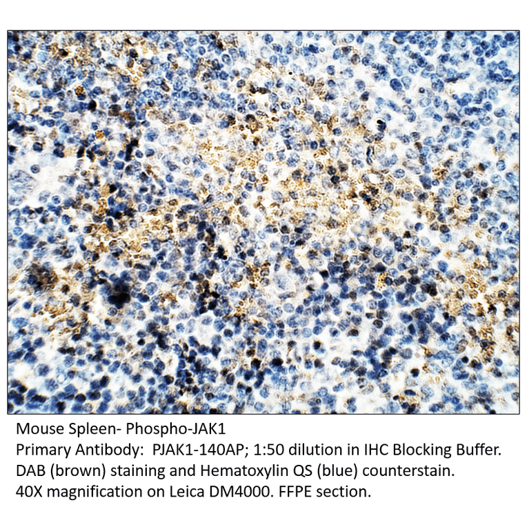 Anti-Phospho-JAK1 Antibody from FabGennix (PJAK1-140AP) - Antibodies.com