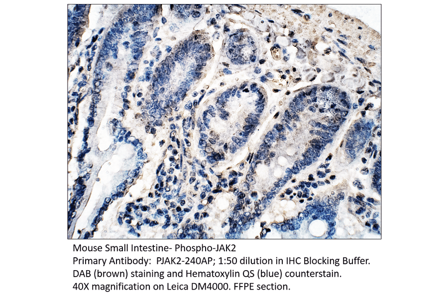 Anti-Phospho-JAK2 Antibody from FabGennix (PJAK2-240AP) - Antibodies.com