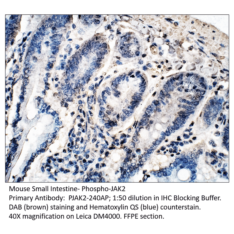Anti-Phospho-JAK2 Antibody from FabGennix (PJAK2-240AP) - Antibodies.com