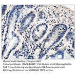 Anti-Phospho-JAK2 Antibody from FabGennix (PJAK2-240AP) - Antibodies.com