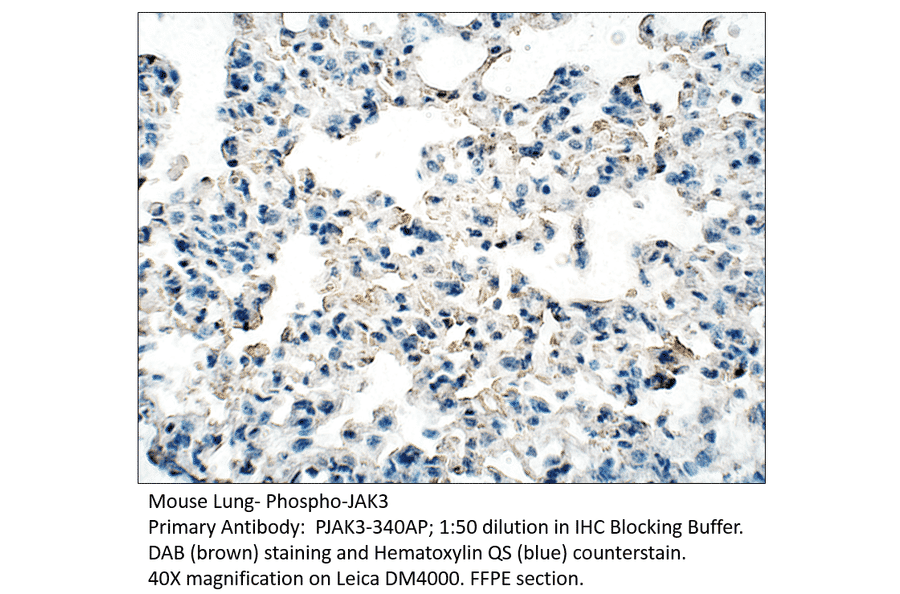 Anti-Phospho-JAK3 Antibody from FabGennix (PJAK3-340AP) - Antibodies.com
