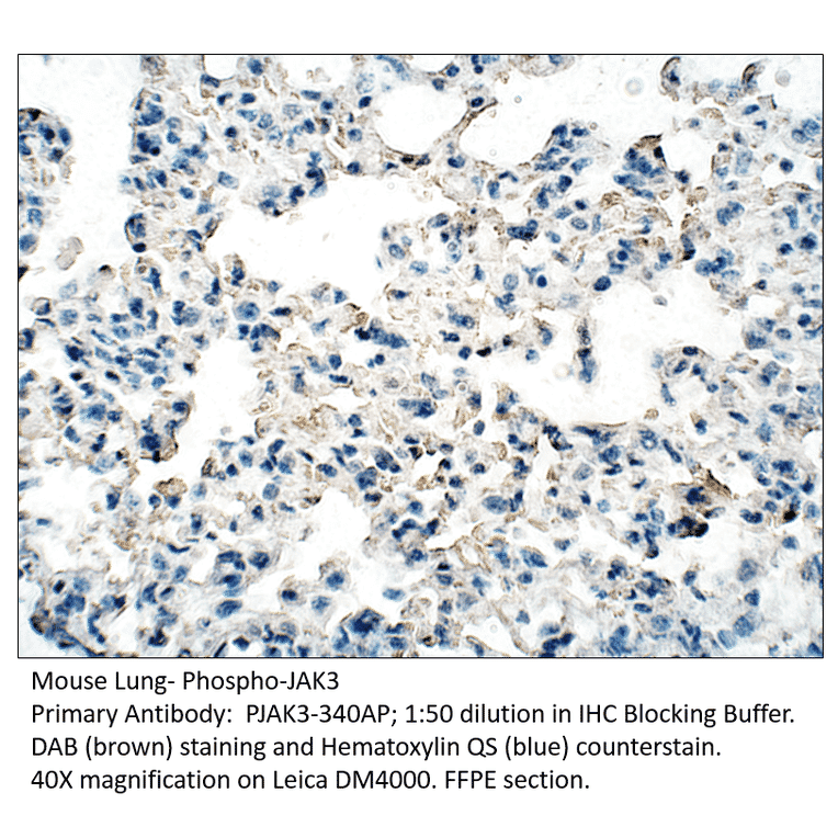 Anti-Phospho-JAK3 Antibody from FabGennix (PJAK3-340AP) - Antibodies.com