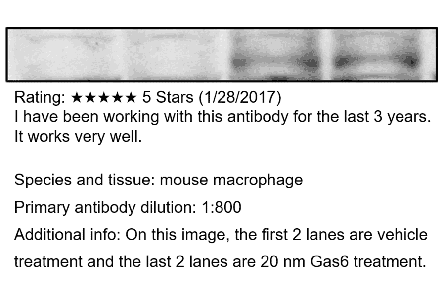 Anti-Phospho-MERTK Antibody from FabGennix (PMKT-140AP) - Antibodies.com