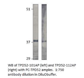 Anti-Prlz / TPD52 Antibody from FabGennix (TPD52-101AP) - Antibodies.com