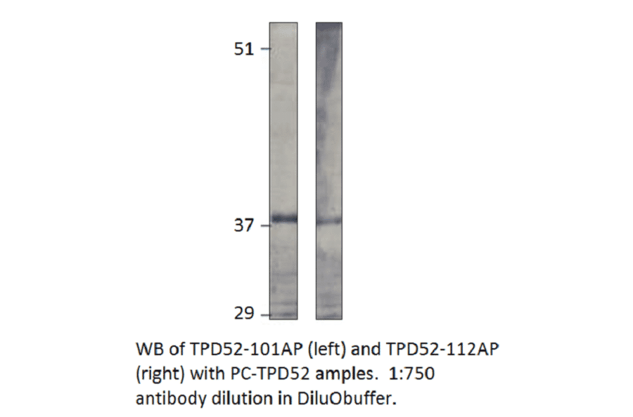 Anti-Prlz / TPD52 Antibody from FabGennix (TPD52-112AP) - Antibodies.com