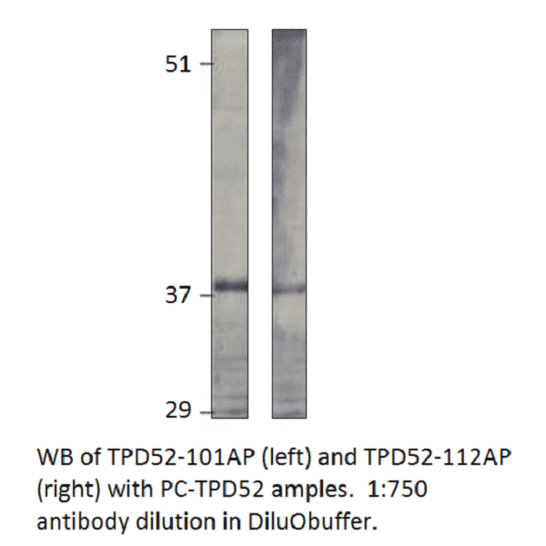 Anti-Prlz / TPD52 Antibody from FabGennix (TPD52-112AP) - Antibodies.com