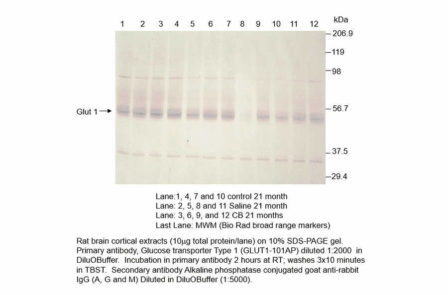 Anti-Glucose Transporter GLUT1 Antibody from FabGennix (GLUT1-101AP) - Antibodies.com