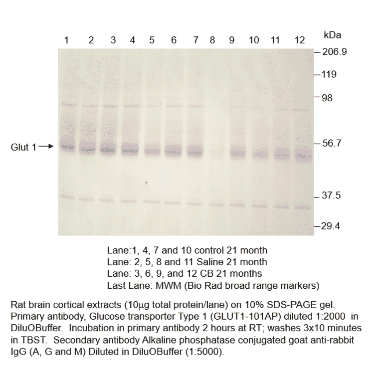 Anti-Glucose Transporter GLUT1 Antibody from FabGennix (GLUT1-101AP) - Antibodies.com