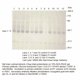 Anti-Glucose Transporter GLUT1 Antibody from FabGennix (GLUT1-101AP) - Antibodies.com