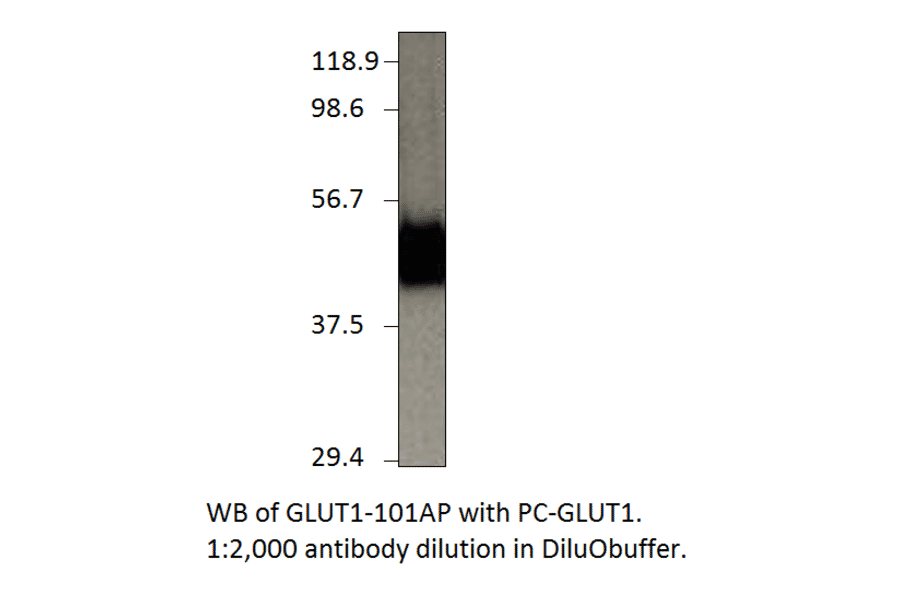Anti-Glucose Transporter GLUT1 Antibody from FabGennix (GLUT1-101AP) - Antibodies.com