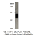 Anti-Glucose Transporter GLUT1 Antibody from FabGennix (GLUT1-101AP) - Antibodies.com