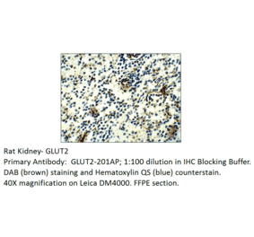 Anti-Glucose Transporter GLUT2 Antibody from FabGennix (GLUT2-201AP) - Antibodies.com