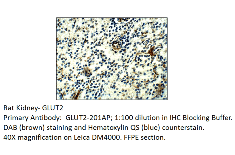 Anti-Glucose Transporter GLUT2 Antibody from FabGennix (GLUT2-201AP) - Antibodies.com
