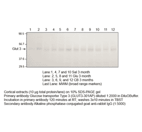Anti-Glucose Transporter GLUT3 Antibody from FabGennix (GLUT3-301AP) - Antibodies.com