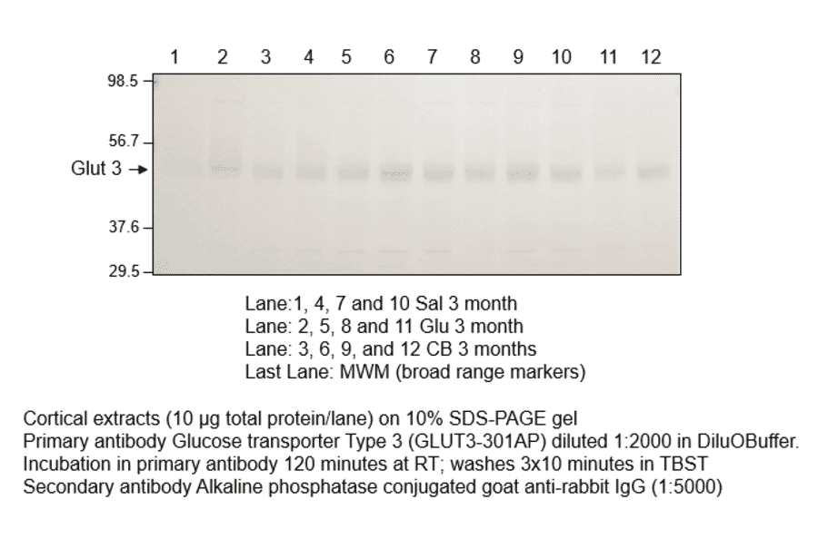 Anti-Glucose Transporter GLUT3 Antibody from FabGennix (GLUT3-301AP) - Antibodies.com