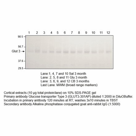 Anti-Glucose Transporter GLUT3 Antibody from FabGennix (GLUT3-301AP) - Antibodies.com