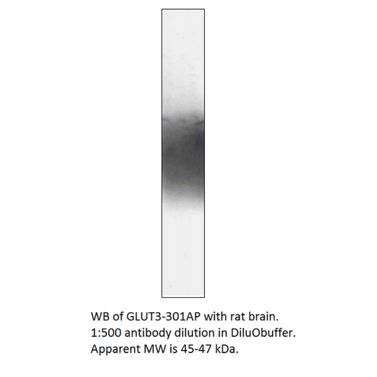 Anti-Glucose Transporter GLUT3 Antibody from FabGennix (GLUT3-301AP) - Antibodies.com