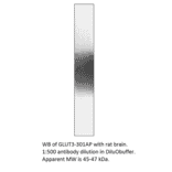 Anti-Glucose Transporter GLUT3 Antibody from FabGennix (GLUT3-301AP) - Antibodies.com