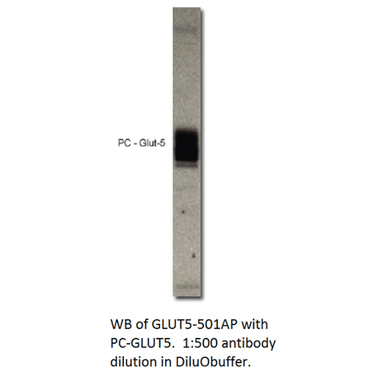 Anti-Glucose transporter GLUT5 Antibody from FabGennix (GLUT5-501AP) - Antibodies.com