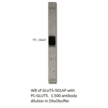 Anti-Glucose transporter GLUT5 Antibody from FabGennix (GLUT5-501AP) - Antibodies.com