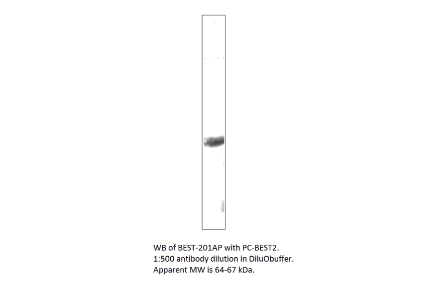 Anti-Bestrophin 2 Antibody from FabGennix (BEST-201AP) - Antibodies.com