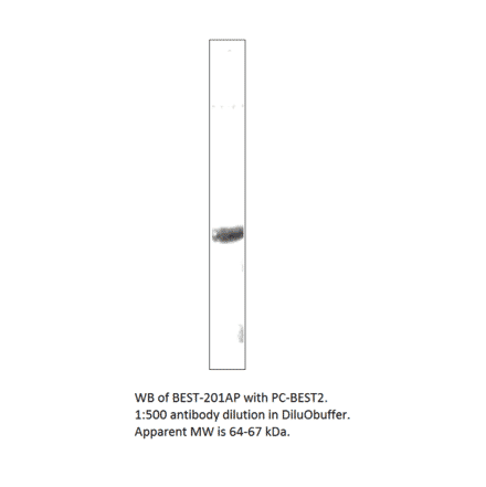 Anti-Bestrophin 2 Antibody from FabGennix (BEST-201AP) - Antibodies.com