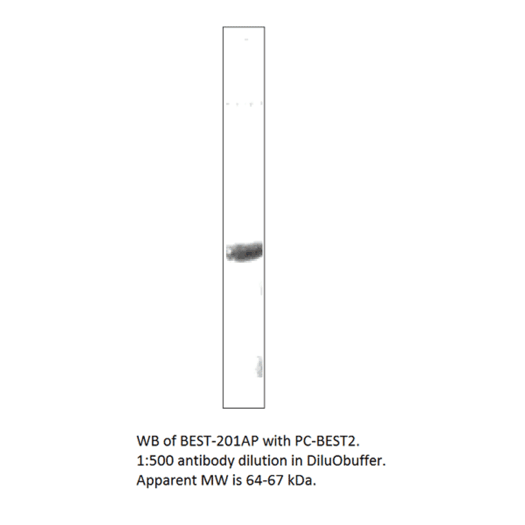Anti-Bestrophin 2 Antibody from FabGennix (BEST-201AP) - Antibodies.com