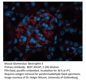 Anti-Bestrophin 3 Antibody from FabGennix (BEST-301AP) - Antibodies.com