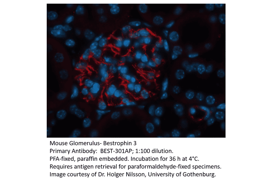 Anti-Bestrophin 3 Antibody from FabGennix (BEST-301AP) - Antibodies.com