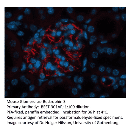 Anti-Bestrophin 3 Antibody from FabGennix (BEST-301AP) - Antibodies.com