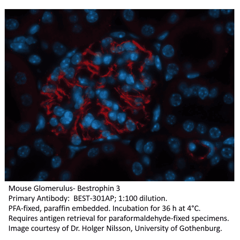 Anti-Bestrophin 3 Antibody from FabGennix (BEST-301AP) - Antibodies.com