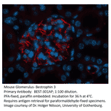 Anti-Bestrophin 3 Antibody from FabGennix (BEST-301AP) - Antibodies.com