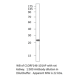 Anti-C1orf146 Antibody from FabGennix (C1ORF146-101AP) - Antibodies.com