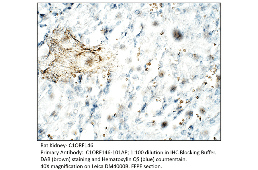 Anti-C1orf146 Antibody from FabGennix (C1ORF146-101AP) - Antibodies.com