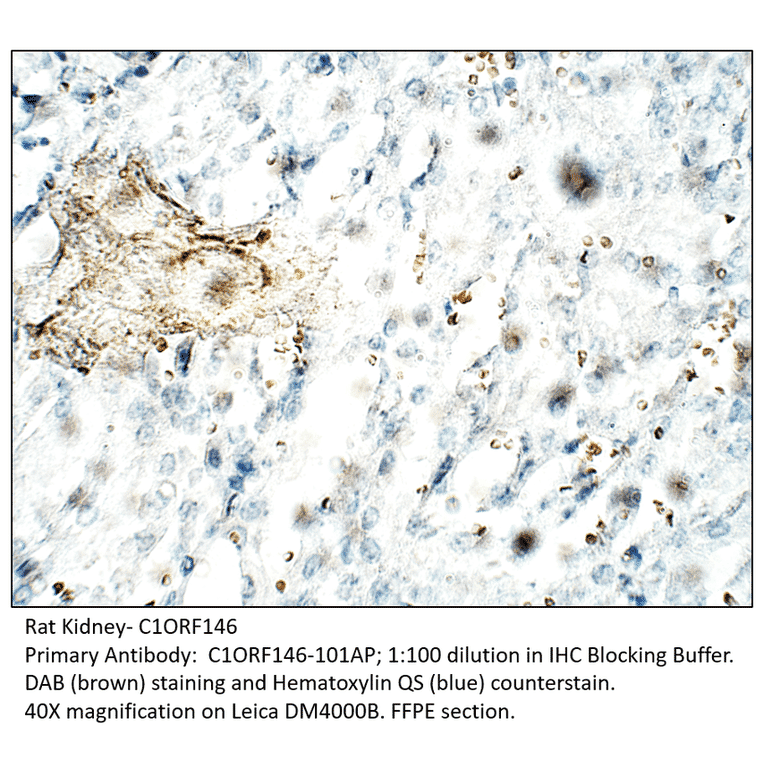 Anti-C1orf146 Antibody from FabGennix (C1ORF146-101AP) - Antibodies.com