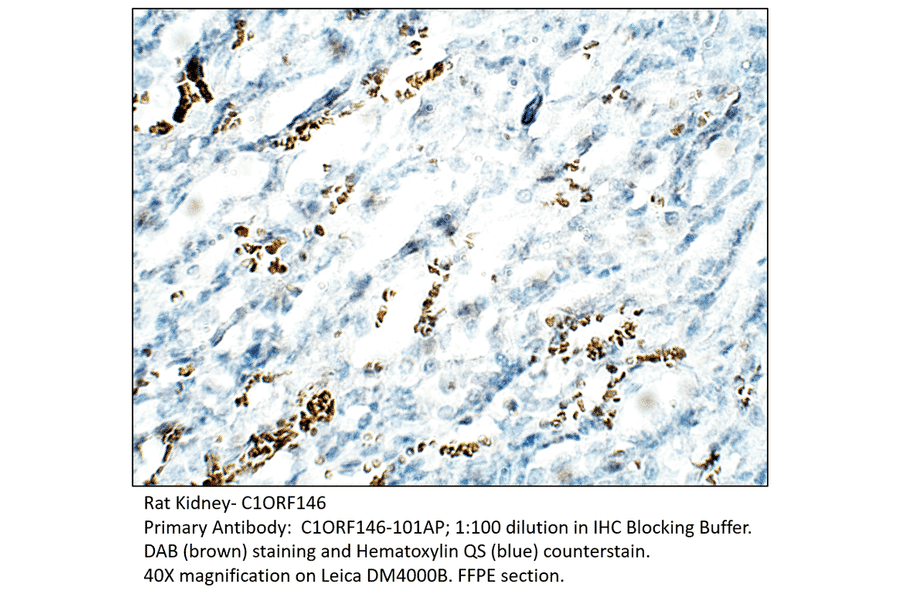 Anti-C1orf146 Antibody from FabGennix (C1ORF146-101AP) - Antibodies.com